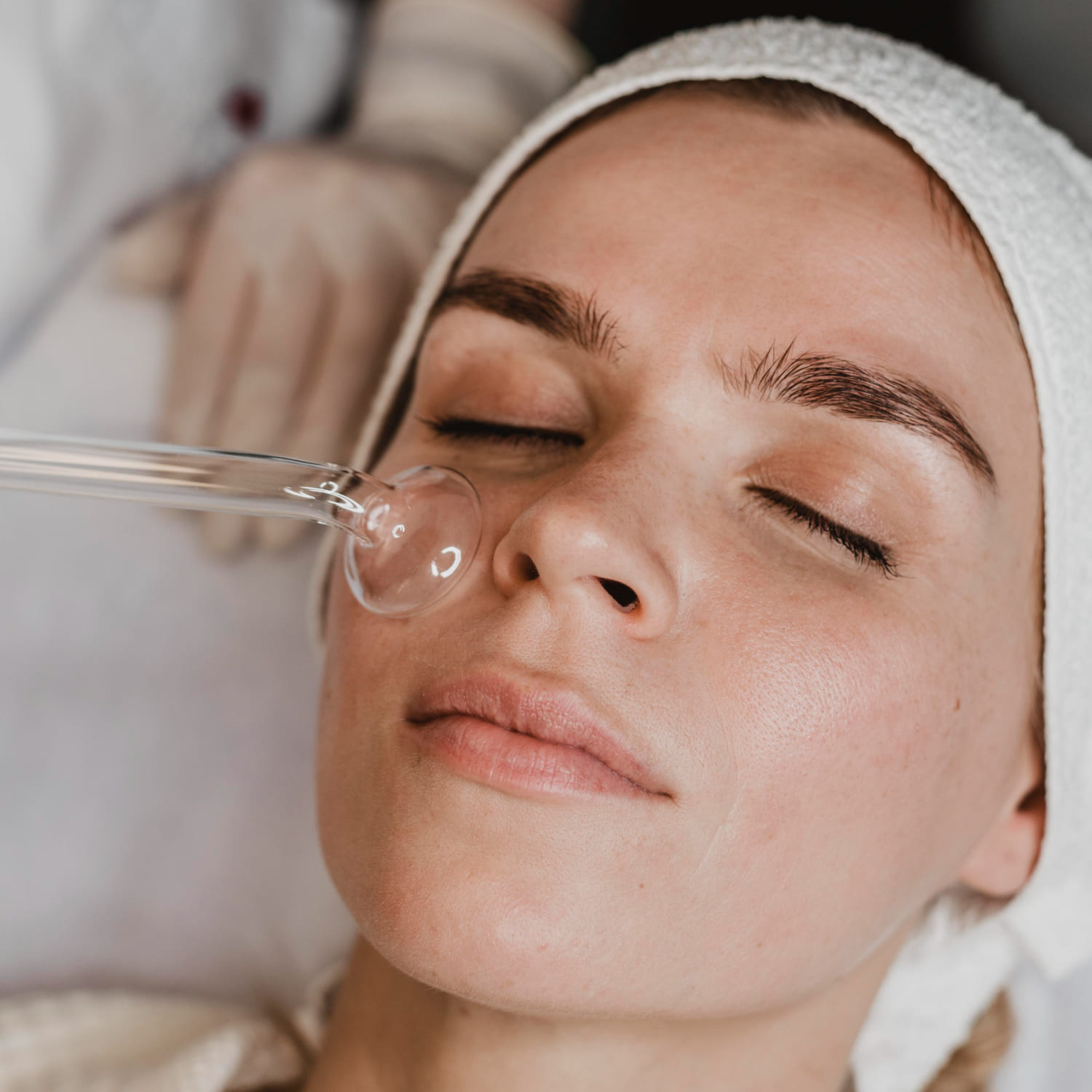 Deep Chemical Peel