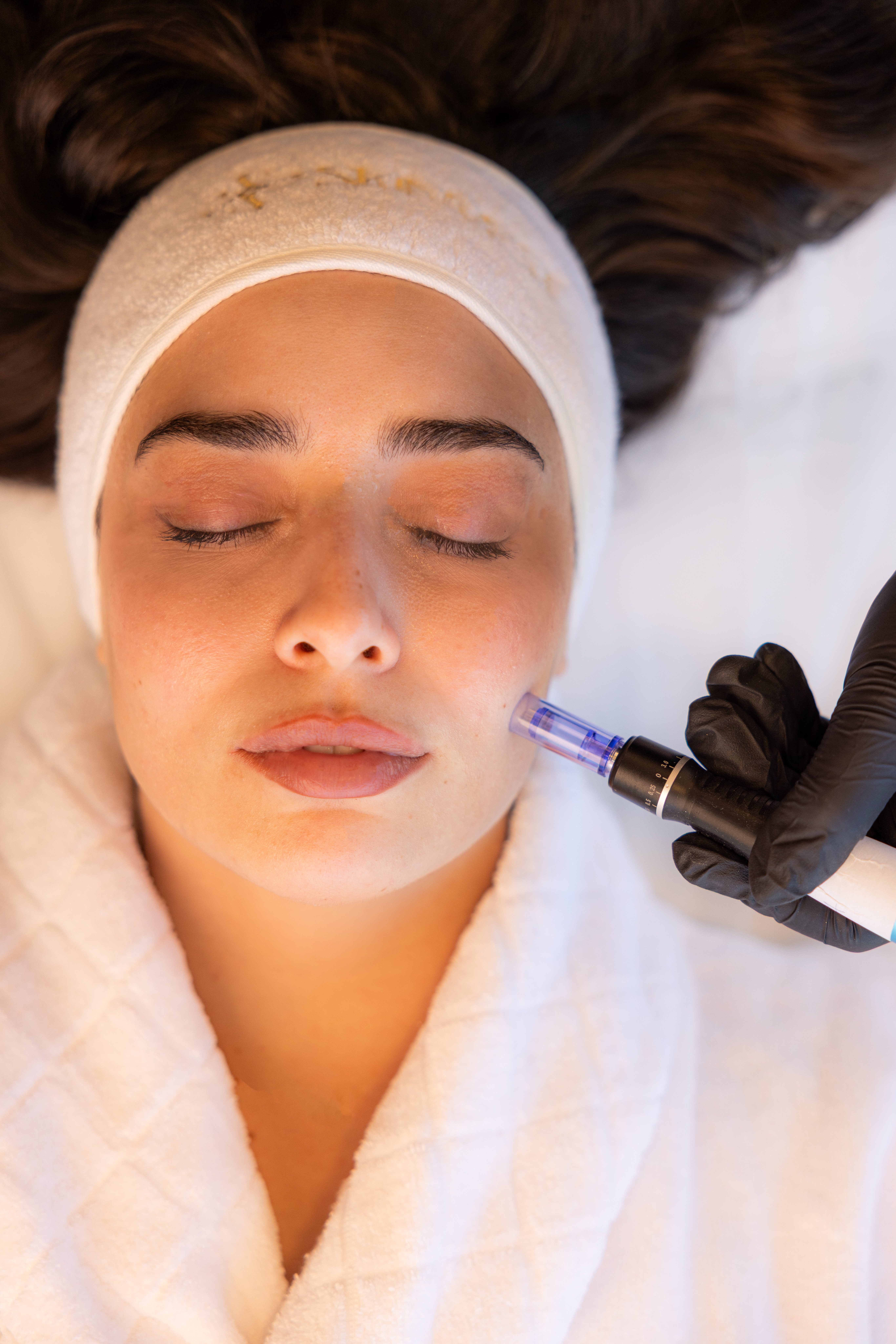 Mesotherapy