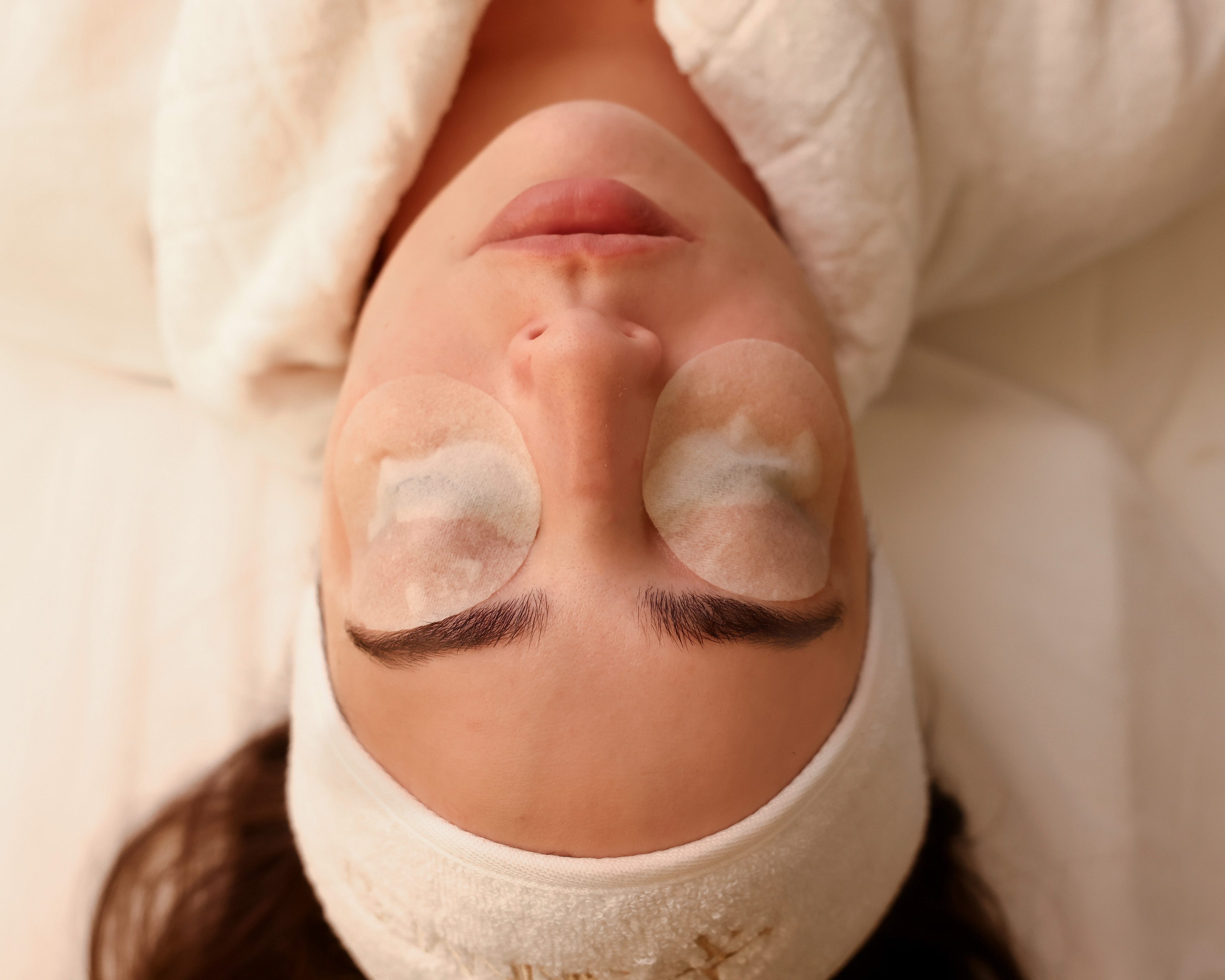 Chemical Peel