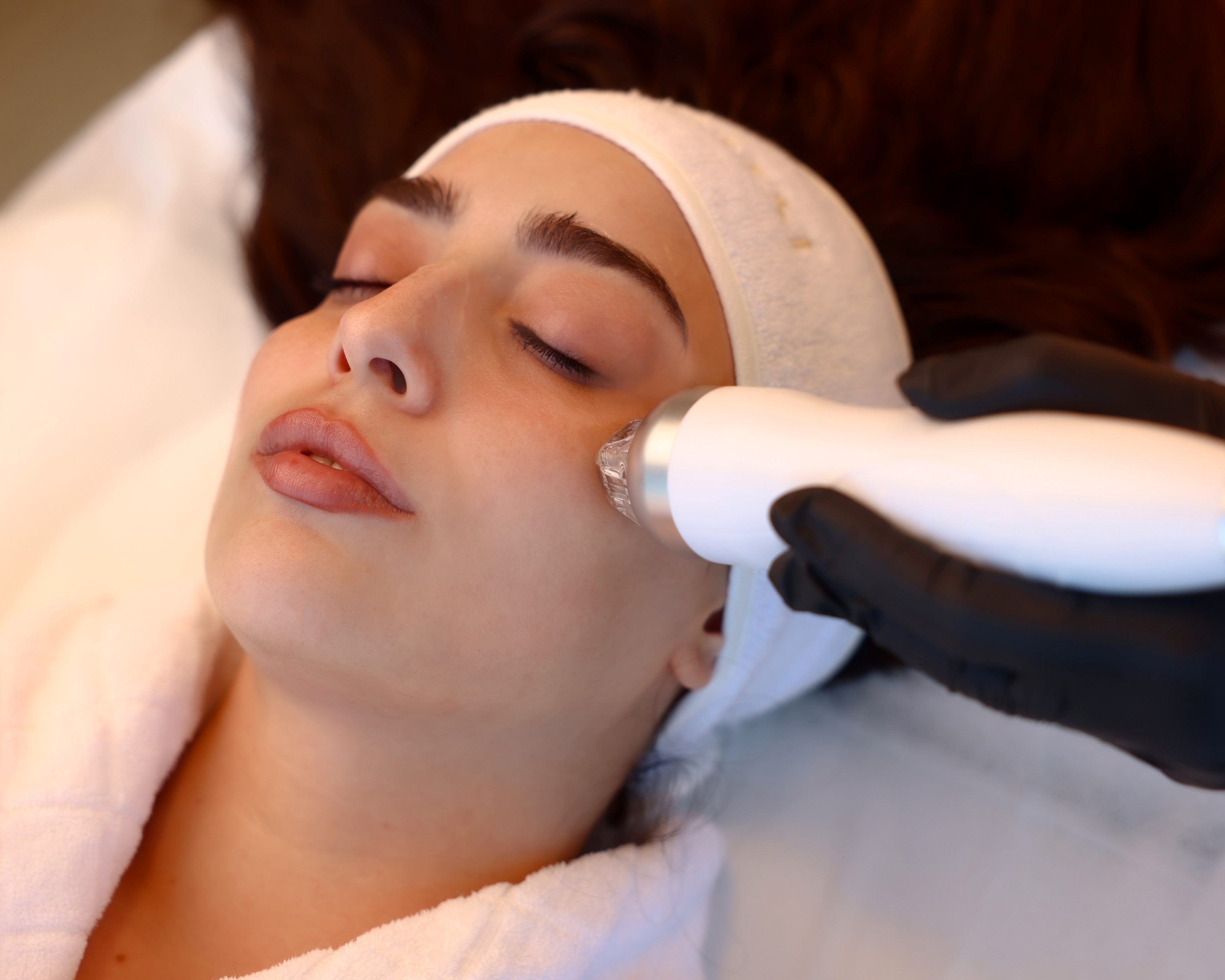 RF/Microneedling